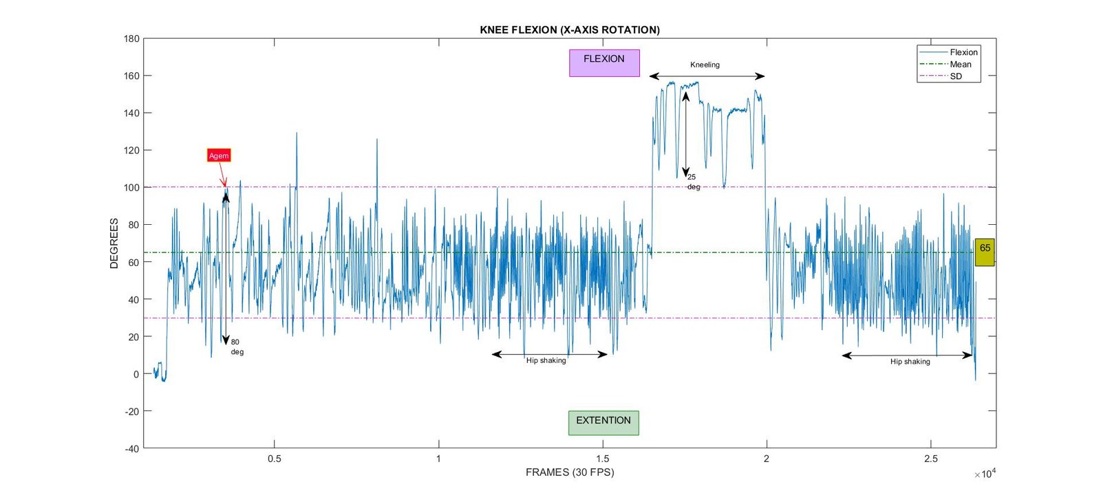 Knee Flexion