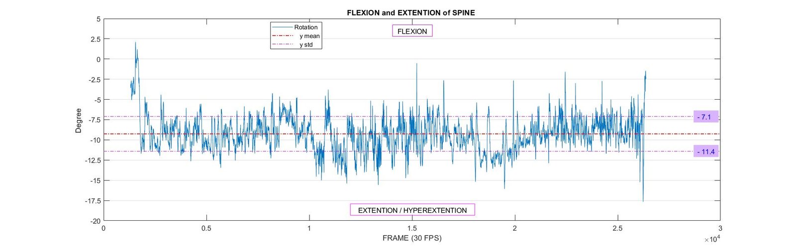Flexion and Extension of Spine